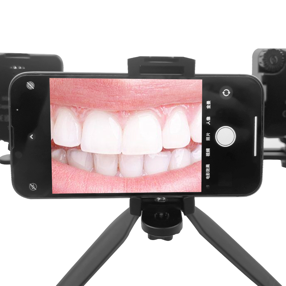 Luz intraoral para fotografia  - Lighting Visual avaliação e preço